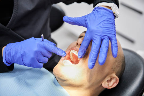 Best Emergency Dental Care for Sports Injuries in Osceola Mills, PA